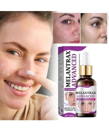  G n rique Anti-Hyperpigmentation Liquid Face Lift Brightening Lifting 30ml for Day and Night Moisturizing Nourishing Solution for Women Girls Feeling Beautiful Sets Visible Results - Buy Online on GoSupps.com