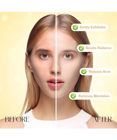 3X100ml Orange 2026 Updated Enzyme Exfoliating Gel The Orange Enzyme Exfoliating Gel Faical Scrub for Smoothing Cleaning - Buy Online on GoSupps.com