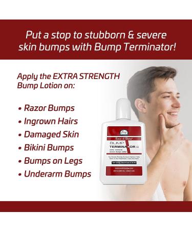 BUMP TERMINATOR Extra Strength Severe Bumps Lotion 6.8 fl oz by Breej - Effective Treatment for Razor Bumps 200ml - Buy Online on GoSupps.com