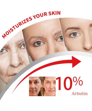 Alpha Arbutin Serum with Nicotinamide - Face Serum to Moisturizing Control Excess Oil - Hyaluronic Acid Serum to Improve Dull Skin - Arbutin to Plump and Smooth Skin for All Skin Types - Buy Online on GoSupps.com