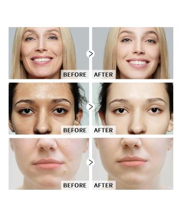 Hyaluronic Acid Serum & Niacinamide Serum Set 2PCS - Reduces Wrinkles Smooths Fine Lines Improves Skin Texture - Facial Serums Moisturizing Oil-Regulating Pore-Minimizing for All Skin Types 2 Fl Oz (Pack of 1) - Buy Online on GoSupps.com