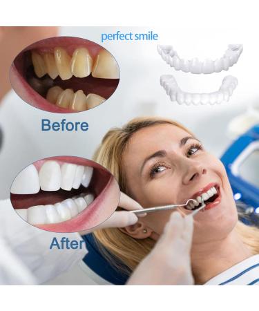 Jiazhou Cosmetic Veneers - Temporary Prostheses for a Perfect Smile | Comfortable Fit & Flexible Braces | White False Teeth (2 Couples) - Buy Online on GoSupps.com