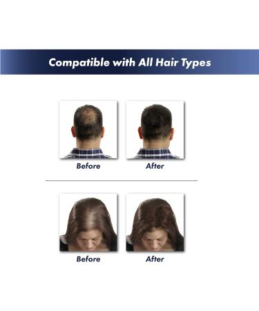 KeraFiber Professional Black Hair Fibres - Natural Keratin Building Fibres for Full Head of Hair in 30 Seconds - 28g Pack for Men and Women - Buy Online on GoSupps.com