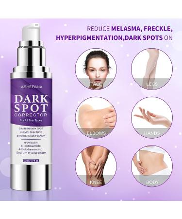 ASHEPANX Dark Spot Remover Cream for Face and Body - Melasma & Hyperpigmentation Treatment | Brightening & Moisturizing Formula | Age Spot & Sun Spot Corrector - Instant Results - Buy Online on GoSupps.com
