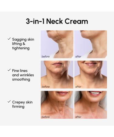 MAREE Neck Cream with Face Roller Neck Creams For Tightening and Firming Pro Retinol & AH-8 Firming Neck Cream Roller - Face Double Chin Wrinkle Cream for Women - Crema Reafirmante Para el Cuello Purple - Buy Online on GoSupps.com