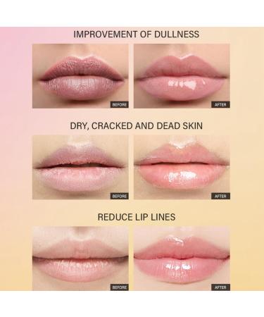 Lip Balm Propolis Lip Scrub Gel Lips Exfoliating Scrub Gel Lip Scrub Exfoliator Moisturizing Repair Lip Dead Skin Gel Lip Lightening for Dark Lips Nursing Lip Dead Skin Gel Overnight Lip Treatment - Buy Online on GoSupps.com