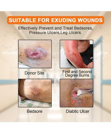 Carbou Sacrum Silicone Foam Dressing 6''x7'' - Waterproof Sacral Pad for Pressure Ulcers - 5 Pack - Buy Online on GoSupps.com