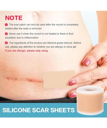 Buy Medical Grade Silicone Scar Sheets | Washable Scar Tape 1.6"x120" Roll - Ideal for Surgical Scars - Buy Online on GoSupps.com