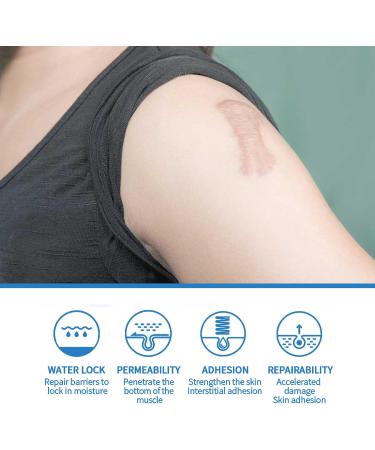 Silicone Scar Gel - Scar Removal Cream - 30g Scar Cream - Scar Removal and Soothing Cream for Surgical Scars Acne Scars C-Section Burns Stretch Marks - Effective for Old and New Scar - Buy Online on GoSupps.com