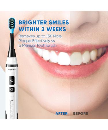 Udefine Electric Toothbrush - 5 Cleaning Modes IPX7 Waterproof 3 Dupont Heads Timer - Ideal for Kids - Buy Online on GoSupps.com