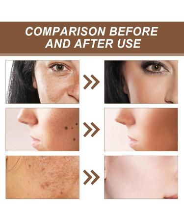 Glutathione Face Cream Glutathione Anti-Aging Face Cream for Women & Men Glutathione Hydrating & Whitening Cream Dark Spot Remover for Face Skin Brightener Cream Face Moisturiser Skin Care Moisturizer - Buy Online on GoSupps.com