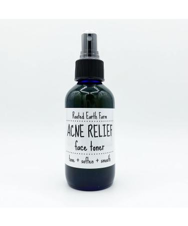 Acne Relief Face Toner - 4 fl oz - for Clear Skin - Natural Astringent - Buy Online on GoSupps.com