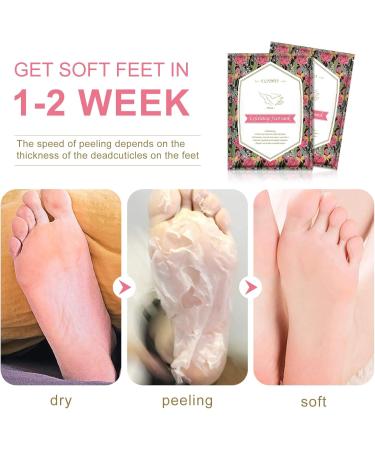 Exfoliating Foot Mask 4 Pairs Moisturizes Nourishes Foot Peel Mask Natural Ingredients Peel Away Hard Skin Calluses Renew Skin Repair And Soften Cracked Heels Feet Masks Exfoliating Socks - Buy Online on GoSupps.com