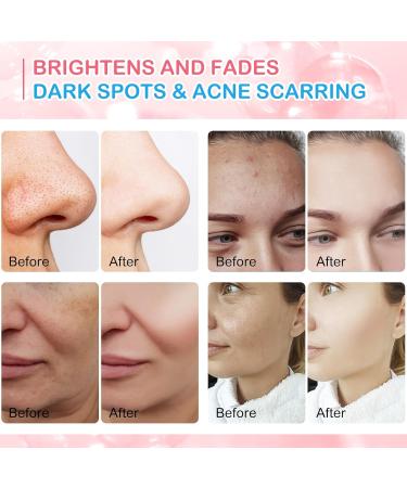 Turmeric & Kojic Acid Cleansing Pads - 40 Exfoliating Pads for Face & Body | Brightening Oil Balancing & Dark Spot Reduction with Vitamin C & B5 - Buy Online on GoSupps.com