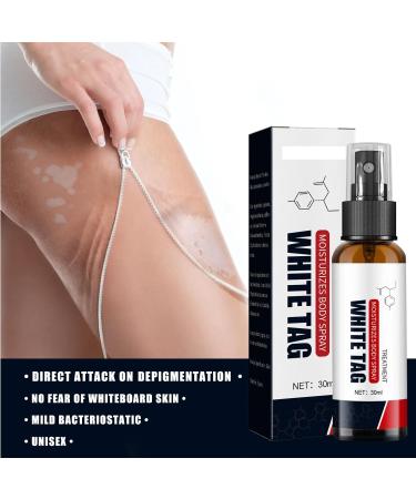 KOAHDE Psoriasis Treatment Spray Vitiligo Relief Spray Psoriasis Control Face and Body Cream Soothing and Moisturizing Coal Tar Psoriasis Cream Spray Psoriasis Control White Spot Spray 30ml 1PC - Buy Online on GoSupps.com