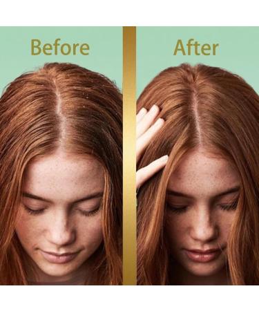  Generisch Natural Triangular Bar Shampoo 120g | Nutritional Strengthening Solid Soap | Richer for Men Teens Adults Seniors | With Travel Home - Buy Online on GoSupps.com