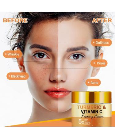 JIAOY Turmeric Vitamin C Face Cream Turmeric Facial Moisturizer for Dark Spots Wrinkles Uneven Skin Tone Antiaging Turmeric Whitening Cream Vitamin C Cream for 4 Pieces - Buy Online on GoSupps.com