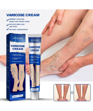 Varicose Veins Cream - Treatment for Leg Spider Vein Relief and Healing - Buy Online on GoSupps.com