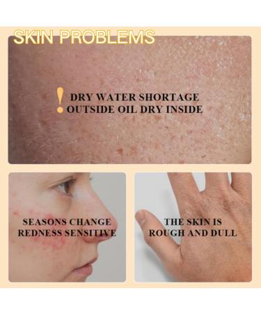 Tallow Face Cream - Moisturiser Face Women - Beef Tallow Face Moisturisers - Beef Tallow Skin Care - Deep Nourish Face Cream - 100% Organic Beef Tallow & Cold Pressed Sweet Almond Oil - Buy Online on GoSupps.com