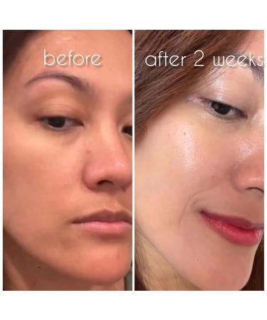 All Time One Cream 100ml - All-in-One Hydrating Hydrogen Cream for Blemishes & Pore Care - Shop Internationally - Buy Online on GoSupps.com