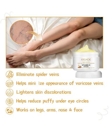 2PCS Varicose Veins Miracle Cream - Vitamin K Formula for Legs & Face | Deeply Nourishing & Moisturizing | All Skin Types - Buy Online on GoSupps.com