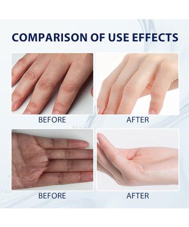 Hankylin Highly Hydrating Hyaluronic Acid Hand Serum Anti-Aging Moisturizing Hand Cream 30g Hydrating Hand Cream with Hyaluronic Acid (2PC) - Buy Online on GoSupps.com