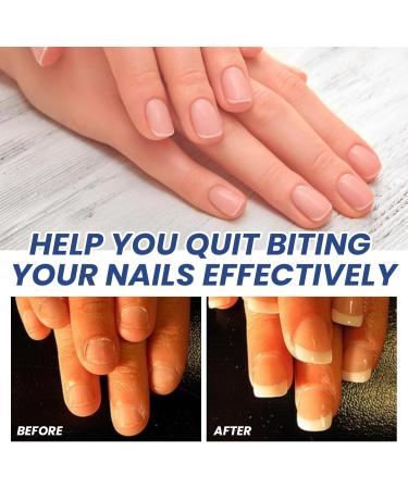 Anti Nail Biting Polish Double Head Stop and Grow Nail Biting Stop Nail Biting Nail Biting Prevention for adults anti nail biting polish Clear Nail Varnish Stop Biting Nails Nail Biter Stopper - Buy Online on GoSupps.com