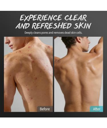 Men Body Scrub with Tea Tree Oil Exfoliating Body Scrub for Men Improve Odor Smooth Rough Skin Body Exfoliator Scrub for Back Chest Shoulders Butt Legs Mens Exfoliating Body Wash with 2% BHA 10% AHA - Buy Online on GoSupps.com