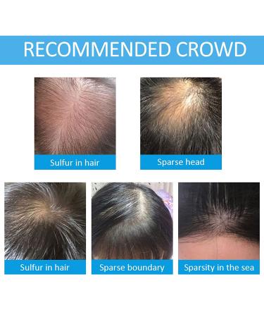 Natural Hair Fibers for Thinning Hair - Instant Thickening Solution for Men & Women - Buy Online on GoSupps.com