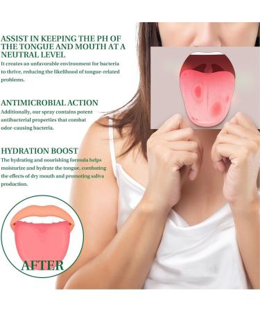3PCS Tongue Relief Treatment Spray Reduce Swelling Tongue Relief Treatment Spray for Bad Breath - Buy Online on GoSupps.com