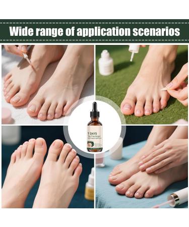 Strengthening and Stimulating Care for Nails 30 ml Natural Nourishing Repair Care for Damaged Nails - Hand and Foot Care for Manicure Pedicure at Home Prevention of Breakage - Buy Online on GoSupps.com