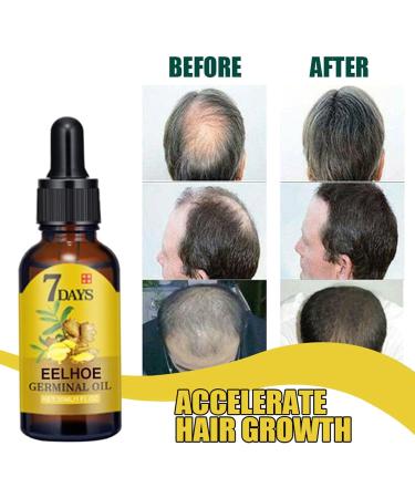 Sloane K-ing of Ginger Hair Growth 7 Days Hair Growth Hair Care Product Hair Serum Fast Hair Growth Accelerated Growth - Buy Online on GoSupps.com