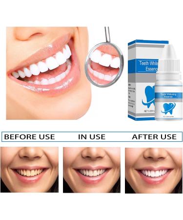 Buy 2pcs Teeth Brightening Liquid Improve Yellow Teeth & Clean Skin | 20ml Perfume PARFUM - Buy Online on GoSupps.com