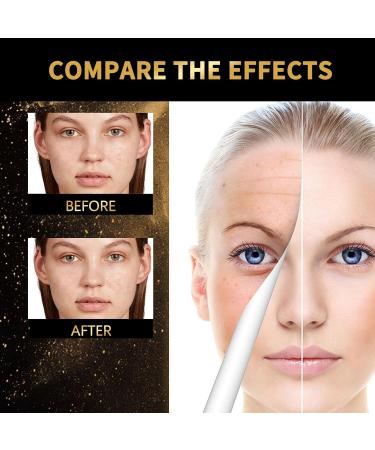  SONGVISON Anti Aging Serum Hydrating Serum Hyaluronic Acid Hydrating Serum Anti Aging Collagen Oils Anti Wrinkle Skin Firming & Prevent Wrinkles Retinol Face Moisturizer for Women - Buy Online on GoSupps.com