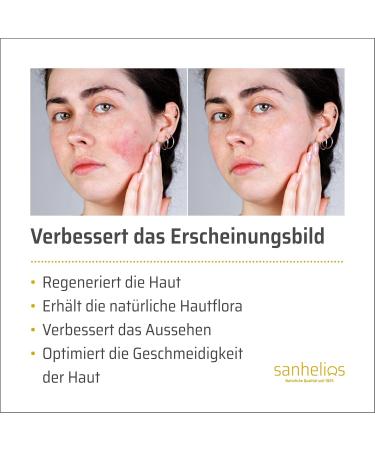 Sanhelios Rosacea Cream - Relieve Redness Itching & Burning | Cortisone-Free Medical Product | 30 ml for Radiant Skin - Buy Online on GoSupps.com