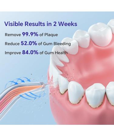 Portable Cordless Water Flosser for Teeth - Ultra Quiet IPX7 Waterproof Oral Irrigator | Rechargeable Dental Care for Travel Home & Office - Buy Online on GoSupps.com