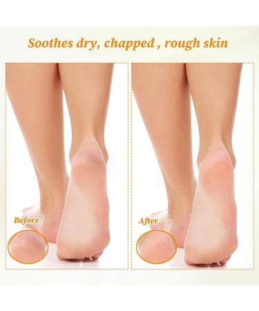 6 Pairs Moisturizing Socks Gloves Set Spa Foot Moisturizer Socks & Cotton Lotion Gloves for Overnight Hydration Repair Dry Hands & Feet Rough Cracked Skin Treatment(Each 3) - Buy Online on GoSupps.com