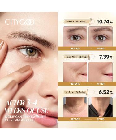 CITYGOO Retinol Eye Stick Hydrating: Dark Circle & Puffiness Balm with Retinol & Collagen - Anti Aging Wrinkle Cream For Women - Travel Friendly and Korean Skin Care 0.35oz/10g Gold 0.35 Ounce (Pack of 1) - Buy Online on GoSupps.com