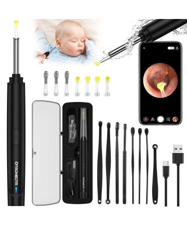 OTAONEOTA Ear Wax Removal Tool Ear Cleaner with 1296P FHD Camera Ear Cleaning Kit with Lights and Built-in WiFi Compatible with iPhone iPad and Android Black