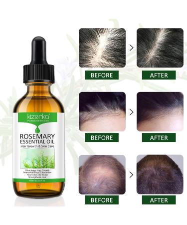 Organic Rosemary Oil for Hair Growth and Skin Care - 60ml | Pure Essential Oil for Hair Loss Treatment - Buy Online on GoSupps.com