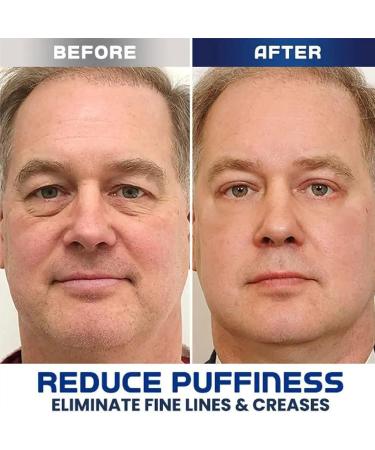 RENTANAC East Moon Mens Cool Tender Eye Cream Instant Firm Eye Tightener Eye Bag Cream Anti Aging Eye Cream Under Eye Awaken Peptide Depuffing Eye Gel Reduces Puffiness - Buy Online on GoSupps.com