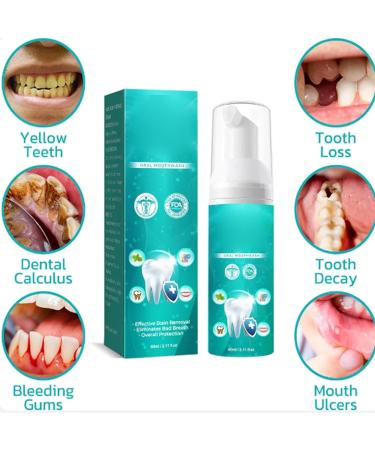Furzero Smartsmile Mouthwash - Herbal Teeth Whitening & Deep Cleaning - Refreshing Breath 2PCs - Buy Online on GoSupps.com