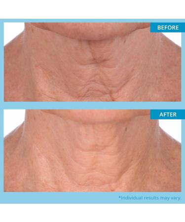 SKINN Neck Cream for Wrinkles | Firming & Tightening Neck Amour Mask - Anti-Aging Chin & Neck Lotion for Men & Women - Buy Online on GoSupps.com