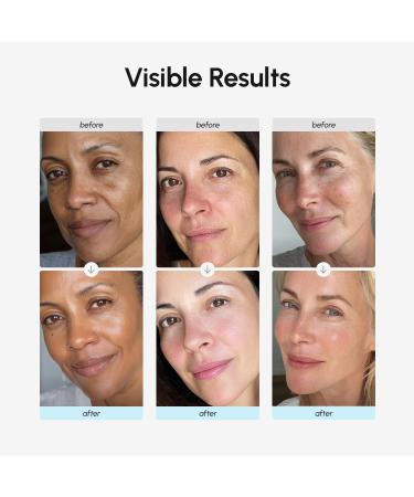 MAREE Face Moisturizer Retinol Cream for Face Daily Wrinkle Cream for Women Anti-Aging Face Cream Facial Moisturizer with Collagen Crema Hidratante Para la Cara for Skin Tightening 1.7 Fl Oz (Pack of 1) - Buy Online on GoSupps.com