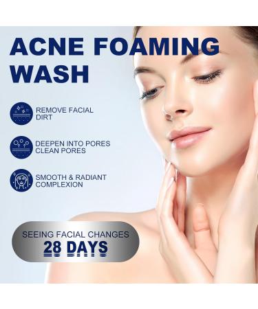  Luthasolic Akne Clean Foam Cleanser 170 g Acne Foaming Wash Akne Gentle Facial Cleansing Foam Deep Pore Cleansing Foam for Facial Cleansing Against Makeup Dirt (4%) - Buy Online on GoSupps.com