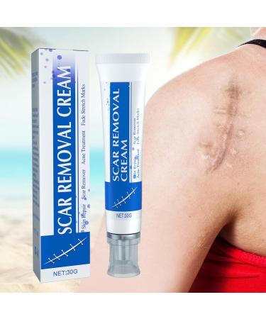  LINGJIONG Anti-stretch mark cream 30 soothing cream for old scars | Scar smoothing reduces the appearance of aging and new scars for stretch marks injuries - Buy Online on GoSupps.com