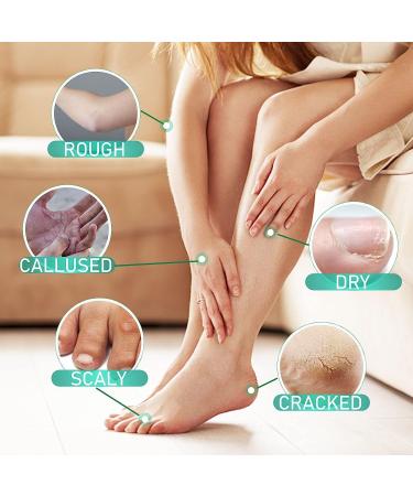 TBeautfave Urea Foot Cream 40% Urea Cream Callus Remover For Dry And Hard Skin Cracked Heel Repair Cream Deep Moisturizing Feet Cream Nourishes Soften for Feet Elbows Knees - Buy Online on GoSupps.com