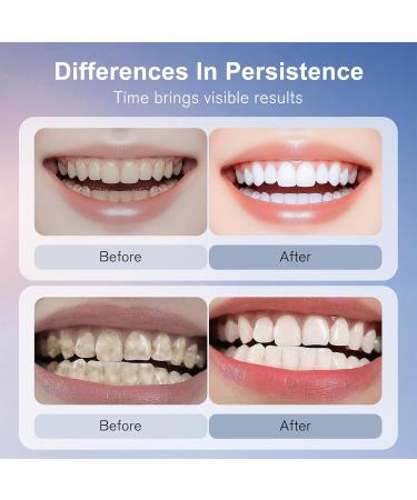 Niacinamide Whitening Toothpaste for Fresh Breath Teeth Brightening Mint Flavor for Sensitive Teeth - Buy Online on GoSupps.com