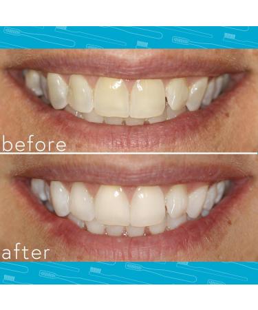 Smileactives Teeth Whitening Pen - Fast Tooth Whitener Stain Remover & Precision Brush Tip - Dental Quality Gel in Spearmint - Travel Friendly 0.11 fl oz - Buy Online on GoSupps.com