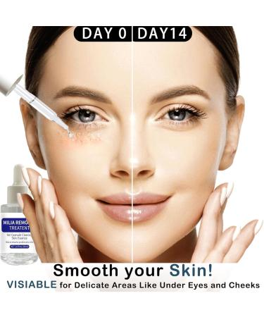 S rum anti-milas un s rum de soin pour le visage et le contour des yeux resserre les pores en douceur att nue les cernes les poches et l'acn . Convient aux soins du visage et du contour des yeux - Buy Online on GoSupps.com
